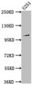 Western Blot; Positive WB detected in: U251 whole cell lysate; All lanes: MME antibody at 1:1500; Secondary; Goat polyclonal to rabbit IgG at 1/50000 dilution; Predicted band size: 86 kDa; Observed band size: 100 kDa Western Blot; Positive WB detected in: U251 whole cell lysate; All lanes: MME antibody at 1:1500; Secondary; Goat polyclonal to rabbit IgG at 1/50000 dilution; Predicted band size: 86 kDa; Observed band size: 100 kDa