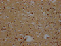 IHC image of RAC07265 diluted at 1:100 and staining in paraffin-embedded human brain tissue performed on a Leica BondTM system. After dewaxing and hydration, antigen retrieval was mediated by high pressure in a citrate buffer (pH 6.0). Section was blocked with 10% normal goat serum 30min at RT. Then primary antibody (1% BSA) was incubated at 4? overnight. The primary is detected by a Goat anti-rabbit IgG polymer labeled by HRP and visualized using 0.05% DAB.