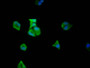 Immunofluorescence staining of Hela Cells with RAC07312 at 1:50, counter-stained with DAPI. The cells were fixed in 4% formaldehyde, permeated by 0.2% TritonX-100, and blocked in 10% normal Goat Serum. The cells were then incubated with the antibody overnight at 4?. Nuclear DNA was labeled in blue with DAPI. The secondary antibody was FITC-conjugated AffiniPure Goat Anti-Rabbit IgG (H+L).