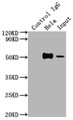 Immunoprecipitating FOXA1 in Hela whole cell lysate; Lane 1: Rabbit control IgG instead of RAC07347 in Hela whole cell lysate.For western blotting,a HRP-conjugated Protein G antibody was used as the secondary antibody (1/2000); Lane 2: RAC07347(2ug)+ Hela whole cell lysate(500ug); Lane 3: Hela whole cell lysate (10ug) Immunoprecipitating FOXA1 in Hela whole cell lysate; Lane 1: Rabbit control IgG instead of RAC07347 in Hela whole cell lysate.For western blotting,a HRP-conjugated Protein G antibody was used as the secondary antibody (1/2000); Lane 2: RAC07347(2ug)+ Hela whole cell lysate(500ug); Lane 3: Hela whole cell lysate (10ug)