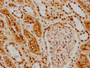 IHC image of RAC07394 diluted at 1:154 and staining in paraffin-embedded human kidney tissue performed on a Leica BondTM system. After dewaxing and hydration, antigen retrieval was mediated by high pressure in a citrate buffer (pH 6.0). Section was blocked with 10% normal goat serum 30min at RT. Then primary antibody (1% BSA) was incubated at 4? overnight. The primary is detected by a biotinylated secondary antibody and visualized using an HRP conjugated SP system. IHC image of RAC07394 diluted at 1:154 and staining in paraffin-embedded human kidney tissue performed on a Leica BondTM system. After dewaxing and hydration, antigen retrieval was mediated by high pressure in a citrate buffer (pH 6.0). Section was blocked with 10% normal goat serum 30min at RT. Then primary antibody (1% BSA) was incubated at 4? overnight. The primary is detected by a biotinylated secondary antibody and visualized using an HRP conjugated SP system.