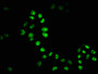 Immunofluorescence staining of Hela cells with RAC07394 at 1:51, counter-stained with DAPI. The cells were fixed in 4% formaldehyde, permeabilized using 0.2% Triton X-100 and blocked in 10% normal Goat Serum. The cells were then incubated with the antibody overnight at 4?. The secondary antibody was Alexa Fluor 488-congugated AffiniPure Goat Anti-Rabbit IgG (H+L). Immunofluorescence staining of Hela cells with RAC07394 at 1:51, counter-stained with DAPI. The cells were fixed in 4% formaldehyde, permeabilized using 0.2% Triton X-100 and blocked in 10% normal Goat Serum. The cells were then incubated with the antibody overnight at 4?. The secondary antibody was Alexa Fluor 488-congugated AffiniPure Goat Anti-Rabbit IgG (H+L).