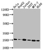 Western Blot; Positive WB detected in: Hela whole cell lysate, HepG2 whole cell lysate, Jurkat whole cell lysate, 293T whole cell lysate, MCF-7 whole cell lysate, HL60 whole cell lysate; All lanes: HMGB1 antibody at 1:2000; Secondary; Goat polyclonal to rabbit IgG at 1/50000 dilution; Predicted band size: 25 kDa; Observed band size: 25 kDa
