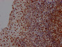IHC image of RAC07406 diluted at 1:100 and staining in paraffin-embedded human tonsil tissue performed on a Leica BondTM system. After dewaxing and hydration, antigen retrieval was mediated by high pressure in a citrate buffer (pH 6.0). Section was blocked with 10% normal goat serum 30min at RT. Then primary antibody (1% BSA) was incubated at 4? overnight. The primary is detected by a Goat anti-rabbit IgG polymer labeled by HRP and visualized using 0.05% DAB.