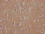 IHC image of RAC07425 diluted at 1:100 and staining in paraffin-embedded human brain tissue performed on a Leica BondTM system. After dewaxing and hydration, antigen retrieval was mediated by high pressure in a citrate buffer (pH 6.0). Section was blocked with 10% normal goat serum 30min at RT. Then primary antibody (1% BSA) was incubated at 4? overnight. The primary is detected by a Goat anti-rabbit IgG polymer labeled by HRP and visualized using 0.05% DAB.