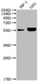 Western Blot; Positive WB detected in: THP-1 whole cell lysate, U251 whole cell lysate; All lanes: IRAK4 antibody at 1:2000; Secondary; Goat polyclonal to rabbit IgG at 1/50000 dilution; Predicted band size: 52, 38 kDa; Observed band size: 55 kDa Western Blot; Positive WB detected in: THP-1 whole cell lysate, U251 whole cell lysate; All lanes: IRAK4 antibody at 1:2000; Secondary; Goat polyclonal to rabbit IgG at 1/50000 dilution; Predicted band size: 52, 38 kDa; Observed band size: 55 kDa