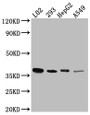 Western Blot; Positive WB detected in: L02 whole cell lysate, HEK293 whole cell lysate, HepG2 whole cell lysate, A549 whole cell lysate; All lanes: LRG1 antibody at 1:1000; Secondary; Goat polyclonal to rabbit IgG at 1/50000 dilution; Predicted band size: 39 kDa; Observed band size: 39 kDa Western Blot; Positive WB detected in: L02 whole cell lysate, HEK293 whole cell lysate, HepG2 whole cell lysate, A549 whole cell lysate; All lanes: LRG1 antibody at 1:1000; Secondary; Goat polyclonal to rabbit IgG at 1/50000 dilution; Predicted band size: 39 kDa; Observed band size: 39 kDa