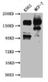 Western Blot; Positive WB detected in: K562 whole cell lysate, MCF-7 whole cell lysate; All lanes: mSin3A antibody at 1:1000; Secondary; Goat polyclonal to rabbit IgG at 1/50000 dilution; Predicted band size: 146 kDa; Observed band size: 146 kDa