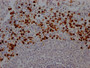 IHC image of RAC07533 diluted at 1:100 and staining in paraffin-embedded human spleen tissue performed on a Leica BondTM system. After dewaxing and hydration, antigen retrieval was mediated by high pressure in a citrate buffer (pH 6.0). Section was blocked with 10% normal goat serum 30min at RT. Then primary antibody (1% BSA) was incubated at 4? overnight. The primary is detected by a Goat anti-rabbit IgG polymer labeled by HRP and visualized using 0.05% DAB.
