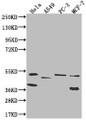 Western Blot; Positive WB detected in: Hela whole cell lysate, A549 whole cell lysate, PC-3 whole cell lysate, MCF-7 whole cell lysate; All lanes: PLEKHA1 antibody at 1:1000; Secondary; Goat polyclonal to rabbit IgG at 1/50000 dilution; Predicted band size: 46, 39 kDa; Observed band size: 36-55 kDa Western Blot; Positive WB detected in: Hela whole cell lysate, A549 whole cell lysate, PC-3 whole cell lysate, MCF-7 whole cell lysate; All lanes: PLEKHA1 antibody at 1:1000; Secondary; Goat polyclonal to rabbit IgG at 1/50000 dilution; Predicted band size: 46, 39 kDa; Observed band size: 36-55 kDa