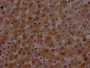 IHC image of RAC07687 diluted at 1:100 and staining in paraffin-embedded human liver tissue performed on a Leica BondTM system. After dewaxing and hydration, antigen retrieval was mediated by high pressure in a citrate buffer (pH 6.0). Section was blocked with 10% normal goat serum 30min at RT. Then primary antibody (1% BSA) was incubated at 4? overnight. The primary is detected by a Goat anti-rabbit IgG polymer labeled by HRP and visualized using 0.05% DAB. IHC image of RAC07687 diluted at 1:100 and staining in paraffin-embedded human liver tissue performed on a Leica BondTM system. After dewaxing and hydration, antigen retrieval was mediated by high pressure in a citrate buffer (pH 6.0). Section was blocked with 10% normal goat serum 30min at RT. Then primary antibody (1% BSA) was incubated at 4? overnight. The primary is detected by a Goat anti-rabbit IgG polymer labeled by HRP and visualized using 0.05% DAB.
