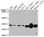 Western Blot; Positive WB detected in: 293 whole cell lysate, K562 whole cell lysate, NIH/3T3 whole cell lysate, PC-3 whole cell lysate, Rat heart tissue, Mouse heart tissue, Mouse liver tissue; All lanes: SDHB antibody at 1:2000; Secondary; Goat polyclonal to rabbit IgG at 1/50000 dilution; Predicted band size: 32 kDa; Observed band size: 32 kDa
