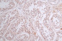 IHC image of RAC07750 diluted at 1:50 and staining in paraffin-embedded human testis tissue performed on a Leica BondTM system. After dewaxing and hydration, antigen retrieval was mediated by high pressure in a citrate buffer (pH 6.0). Section was blocked with 10% normal goat serum 30min at RT. Then primary antibody (1% BSA) was incubated at 4°C overnight. The primary is detected by a Goat anti-rabbit polymer IgG labeled by HRP and visualized using 0.43% DAB.