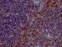 IHC image of RAC07788 diluted at 1:100 and staining in paraffin-embedded human tonsil tissue performed on a Leica BondTM system. After dewaxing and hydration, antigen retrieval was mediated by high pressure in a citrate buffer (pH 6.0). Section was blocked with 10% normal goat serum 30min at RT. Then primary antibody (1% BSA) was incubated at 4? overnight. The primary is detected by a Goat anti-rabbit IgG polymer labeled by HRP and visualized using 0.05% DAB.