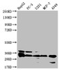 Western Blot; Positive WB detected in: HepG2 whole cell lysate, PC-3 whole cell lysate, U251 whole cell lysate, MCF-7 whole cell lysate, A549 whole cell lysate; All lanes: TMEM192 antibody at 1:1000; Secondary; Goat polyclonal to rabbit IgG at 1/50000 dilution; Predicted band size: 31 kDa; Observed band size: 31 kDa