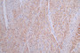 IHC image of RAC07791 diluted at 1:50 and staining in paraffin-embedded human heart tissue performed on a Leica BondTM system. After dewaxing and hydration, antigen retrieval was mediated by high pressure in a citrate buffer (pH 6.0). Section was blocked with 10% normal goat serum 30min at RT. Then primary antibody (1% BSA) was incubated at 4°C overnight. The primary is detected by a Goat anti-rabbit polymer IgG labeled by HRP and visualized using 0.16% DAB.