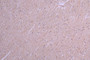 IHC image of RAC07999 diluted at 1:100 and staining in paraffin-embedded human brain tissue performed on a Leica BondTM system. After dewaxing and hydration, antigen retrieval was mediated by high pressure in a citrate buffer (pH 6.0). Section was blocked with 10% normal goat serum 30min at RT. Then primary antibody (1% BSA) was incubated at 4°C overnight. The primary is detected by a Goat anti-Human IgG labeled by HRP and visualized using 0.05% DAB.
