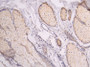 IHC image diluted at 1:100 and staining in paraffin-embedded human skin tissue performed on a Leica BondTM system. After dewaxing and hydration, antigen retrieval was mediated by high pressure in a citrate buffer (pH 6.0). Section was blocked with 10% normal goat serum 30min at RT. Then primary antibody (1% BSA) was incubated at 4°C overnight. The primary is detected by a Goat anti-human polymer IgG labeled by HRP and visualized using 0.05% DAB.