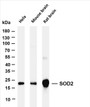 Various whole cell lysates were separated by 4-20% SDS-PAGE, and the membrane was blotted with anti-SOD2 (PT0085R) antibody. The HRP-conjugated Goat anti-Rabbit IgG(H + L) antibody was used to detect the antibody.