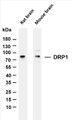 Various whole cell lysates were separated by 4-20% SDS-PAGE, and the membrane was blotted with anti-DRP1 (PT0086R) antibody. The HRP-conjugated Goat anti-Rabbit IgG(H + L) antibody was used to detect the antibody.
