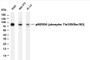 Various whole cell lysates were separated by 4-20% SDS-PAGE, and the membrane was blotted with anti-p90RSK (phospho Thr359/Ser363) (PT0067R) antibody. The HRP-conjugated Goat anti-Rabbit IgG(H + L) antibody was used to detect the antibody.
