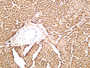 Rat cardiac muscle was stained with anti-Cardiac Troponin T (PT0443R) rabbit antibody