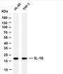Various whole cell lysates were separated by 4-20% SDS-PAGE, and the membrane was blotted with anti-IL-10 (PT0635R) antibody. The HRP-conjugated Goat anti-Rabbit IgG(H + L) antibody was used to detect the antibody.