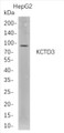 Western Blot analysis of HepG2 whole cell lysates were separated by 4-20% SDS-PAGE, and the membrane was blotted with anti-KCTD3 rabbit mAb. The HRP-conjugated Goat anti-Rabbit IgG(H + L) antibody was used to detect the antibody. Western Blot analysis of HepG2 whole cell lysates were separated by 4-20% SDS-PAGE, and the membrane was blotted with anti-KCTD3 rabbit mAb. The HRP-conjugated Goat anti-Rabbit IgG(H + L) antibody was used to detect the antibody.