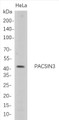 Western Blot analysis of HeLa whole cell lysates were separated by 4-20% SDS-PAGE, and the membrane was blotted with anti-PACSIN3 rabbit mAb. The HRP-conjugated Goat anti-Rabbit IgG(H + L) antibody was used to detect the antibody. Western Blot analysis of HeLa whole cell lysates were separated by 4-20% SDS-PAGE, and the membrane was blotted with anti-PACSIN3 rabbit mAb. The HRP-conjugated Goat anti-Rabbit IgG(H + L) antibody was used to detect the antibody.