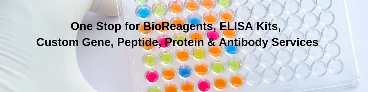 One Stop for BioReagents, ELISA Kits,   Custom Gene, Peptide, Protein &amp; Antibody Services