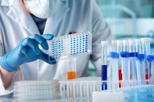 enzyme linked immunosorbent assay
