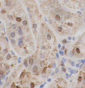 TADBP Polyclonal Antibody, Cat#CAF50482