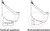 Leaf Eater Advanced Rain Harvesting RHAD100 Both 3" and 4" Compatible