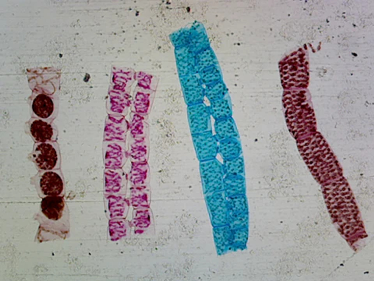 spirogyra conjugation under microscope