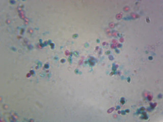 Prepared Microscope Slide, Saccharomyces Cerevisiae, Budding Cells; Whole-mount