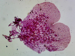 Prepared Microscope Slide, Fern (Pteridophyta) Prothallium, Showing Gametophytes; Cross Section