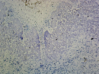 Prepared Microscope Slide, Legume Root Nodule; Section Showing Nitrogen Fixing Bacteria in the Nodules