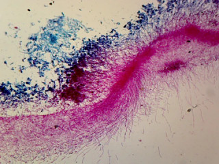 Prepared Microscope Slide, Penicillium; Whole-mount