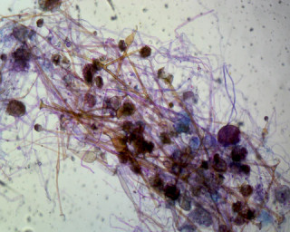 Prepared Microscope Slide, Rhizopus Sporangia; Whole-mount