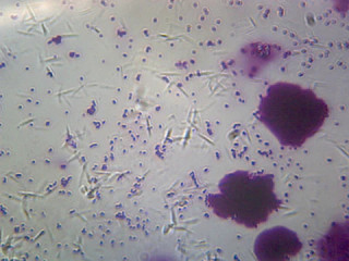 Prepared Microscope Slide, Bacteria from Human Mouth, Showing Different Types; Smear