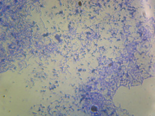 Prepared Microscope Slide, Lactobacillus Casei, Lactic Acid Producer; Smear; Gram-Positive