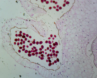 Prepared Microscope Slide, Lilium Anther, First Meiotic Division; Cross Section