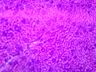 Prepared Microscope Slide, Liver, Human; Showing Hepatic Cells; Section; H&E Stain