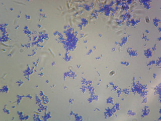 Prepared Microscope Slide, Corynebacterium Diphtheriae, Rod-Shaped; Smear; Gram-Positive