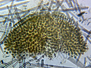 Prepared Microscope Slide, Mixed Spicules; Whole-mount