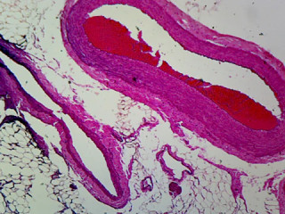 Prepared Microscope Slide, Human Artery, Vein, and Nerve; Cross Section