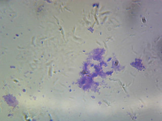 Prepared Microscope Slide, Streptococcus Pneumoniae (Diplococcus); Smear; Gram-Positive