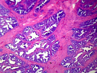 Prepared Microscope Slide, Prostate, Human; Showing Glandular Epithelium; Section; H&E Stain