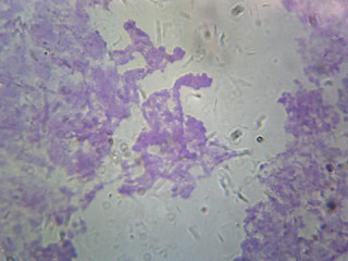 Prepared Microscope Slide, Chromosomes, Drosophila Melanogaster; Smear from Salivary Glands Prepared Microscope Slide, Chromosomes, Drosophila Melanogaster; Smear from Salivary Glands