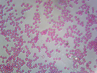 Prepared Microscope Slide, Meningococcus (Neisseria Meningitidis); Smear; Gram-Negative